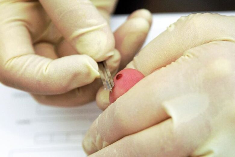 Blood fanding finger